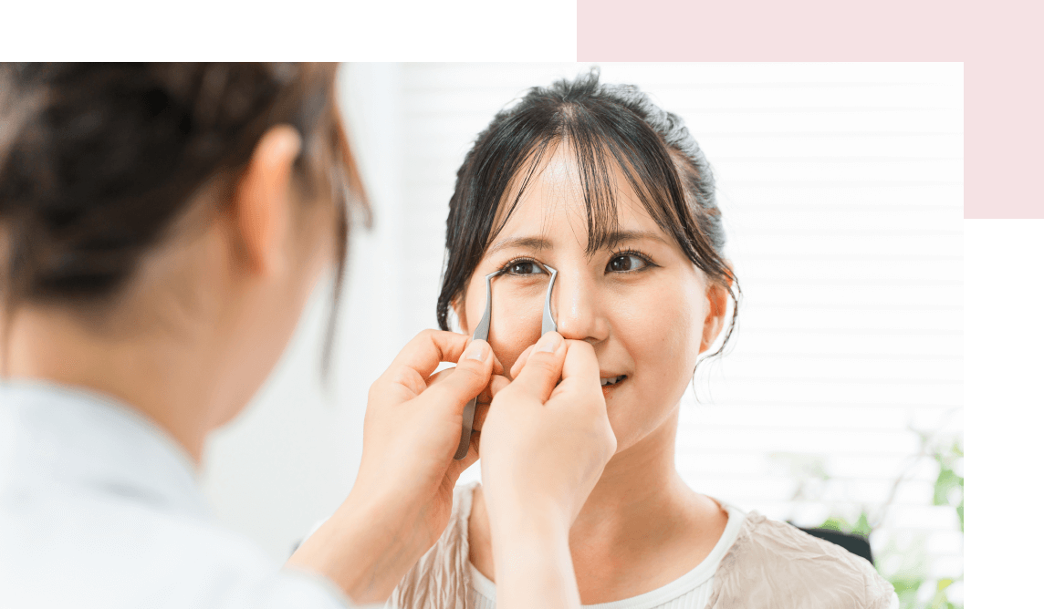 医師と二重幅を相談する女性